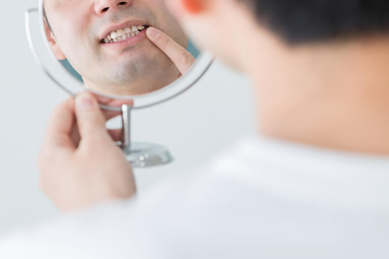 日本人のおよそ８割は歯周病です