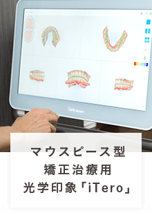 マウスピース型矯正治療用光学印象「iTero」